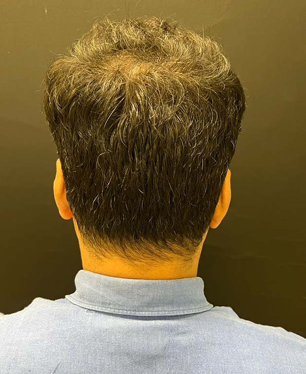 footer-gallery-image-2