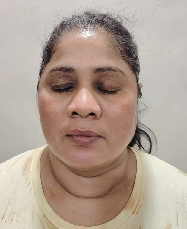 footer-gallery-image-2