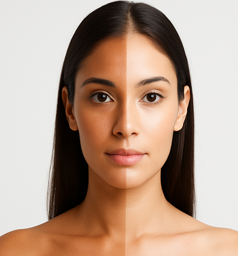 Tan Removal Treatment