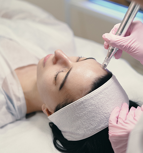 DermaFrac Treatment