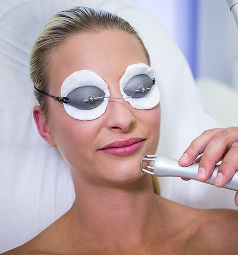 Fractional CO2 Laser Treatment