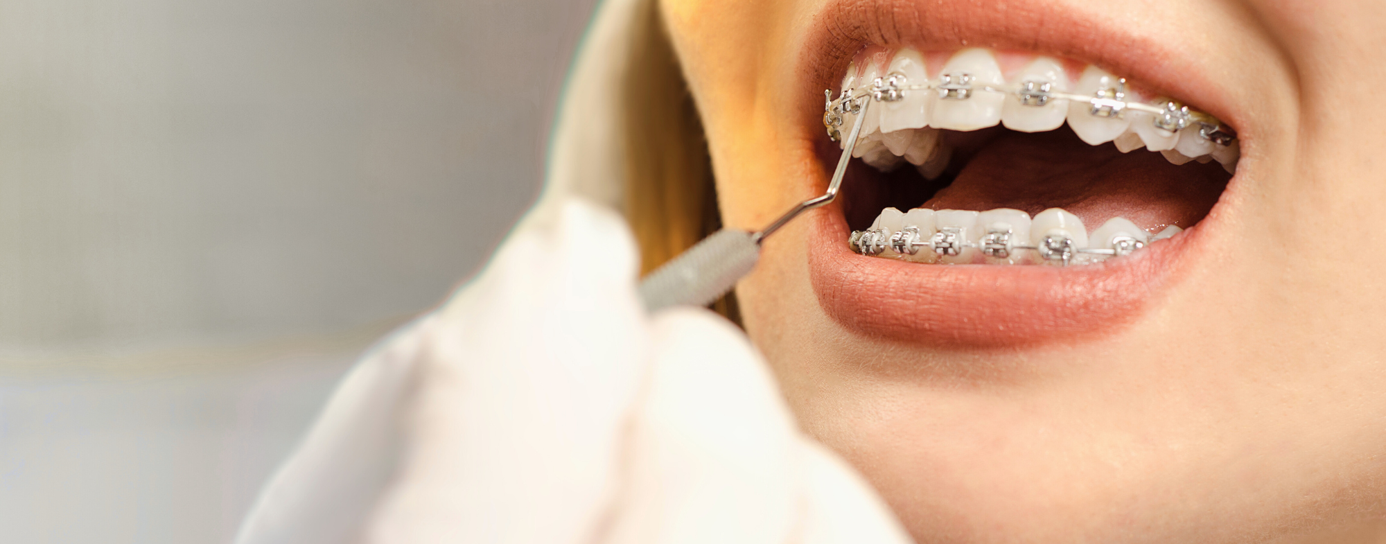 Smile Designing Treatment