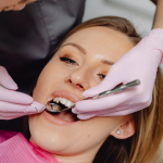 Painless Root Canal Treatment