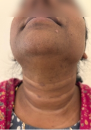 1778826089-480_after.jpg