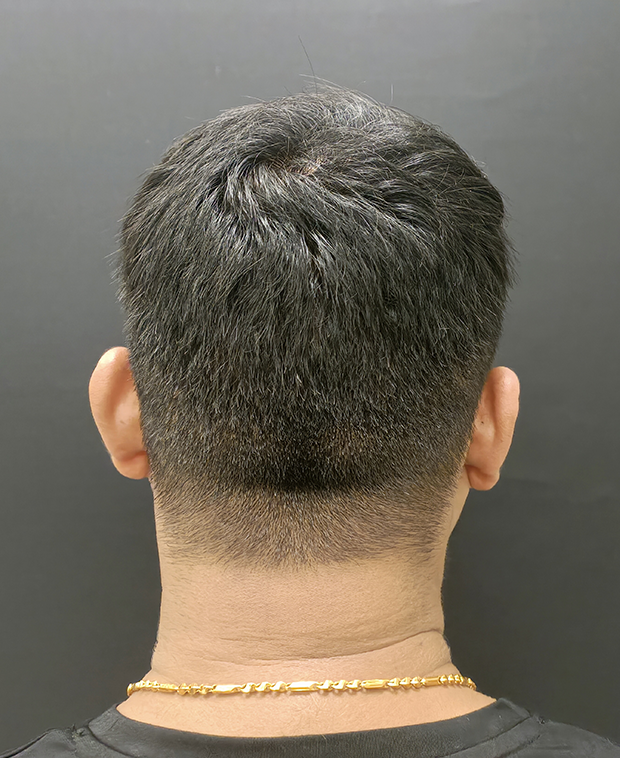 footer-gallery-image-2