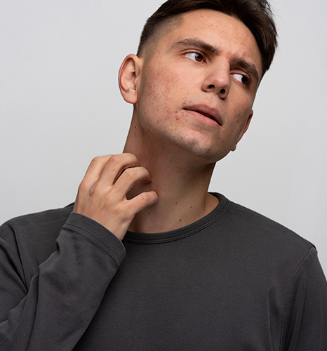 Acanthosis Nigricans