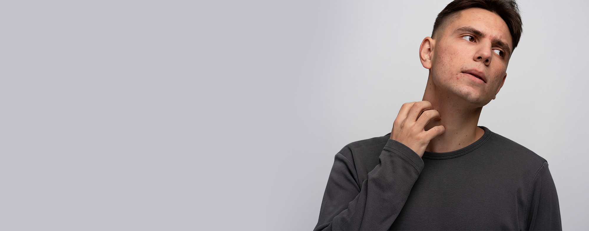 Acanthosis Nigricans